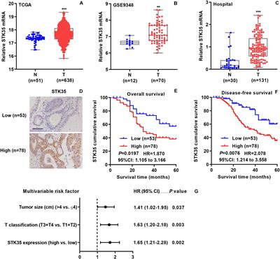 STK35 Is Ubiquitinated by NEDD4L and Promotes Glycolysis and Inhibits Apoptosis Through Regulating the AKT Signaling Pathway, Influencing Chemoresistance of Colorectal Cancer